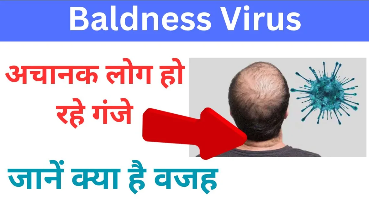 Baldness Virus